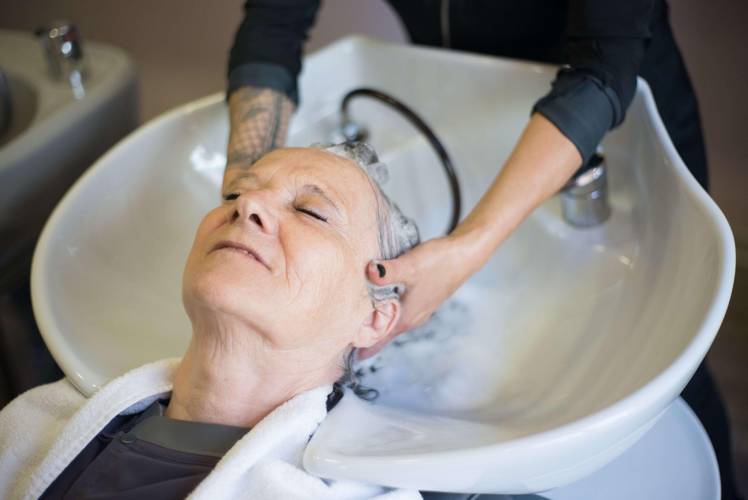 White woman getting hair washed. Seborrheic Dermatitis on Scalp