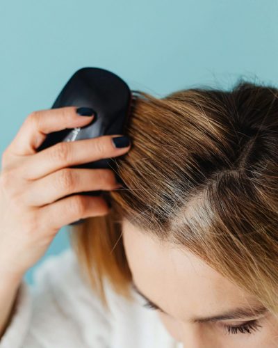 Woman brushing thinning hair due to hair loss.